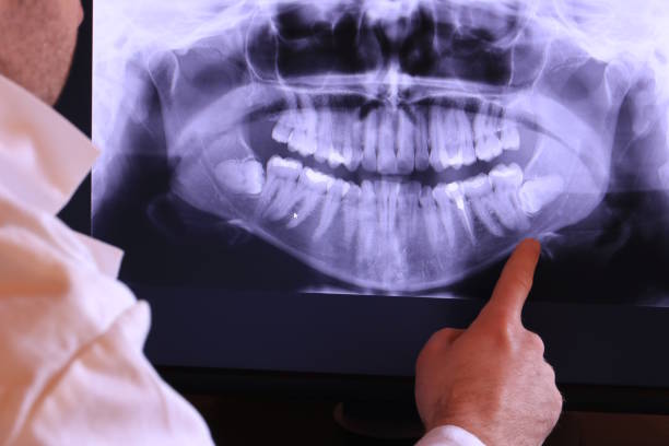 Best Broken or Cracked Tooth Emergency Dentist in Delft Colony, CA